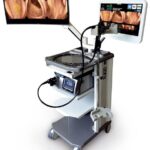 colonoscopy machine